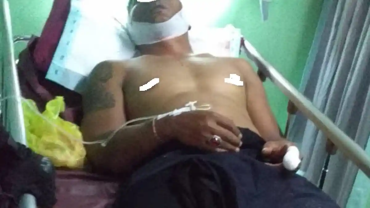 Seorang Pria Diduga Anggota Ormas Alami Luka di Kepala Setelah Bentrok Dengan Oknum Mahasiswa Papua