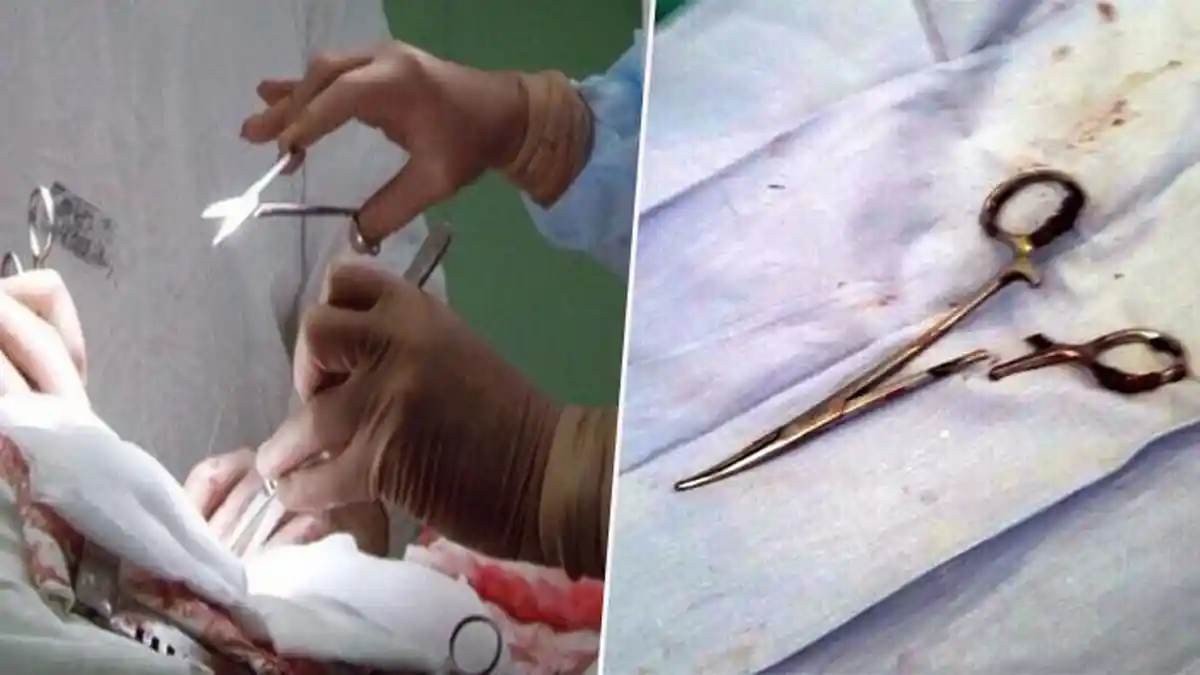 Benda Tak Lazim Ini Berada di Perut Pria Ini Selama 18 Tahun, Dokter yang Menemukannya Terkejut