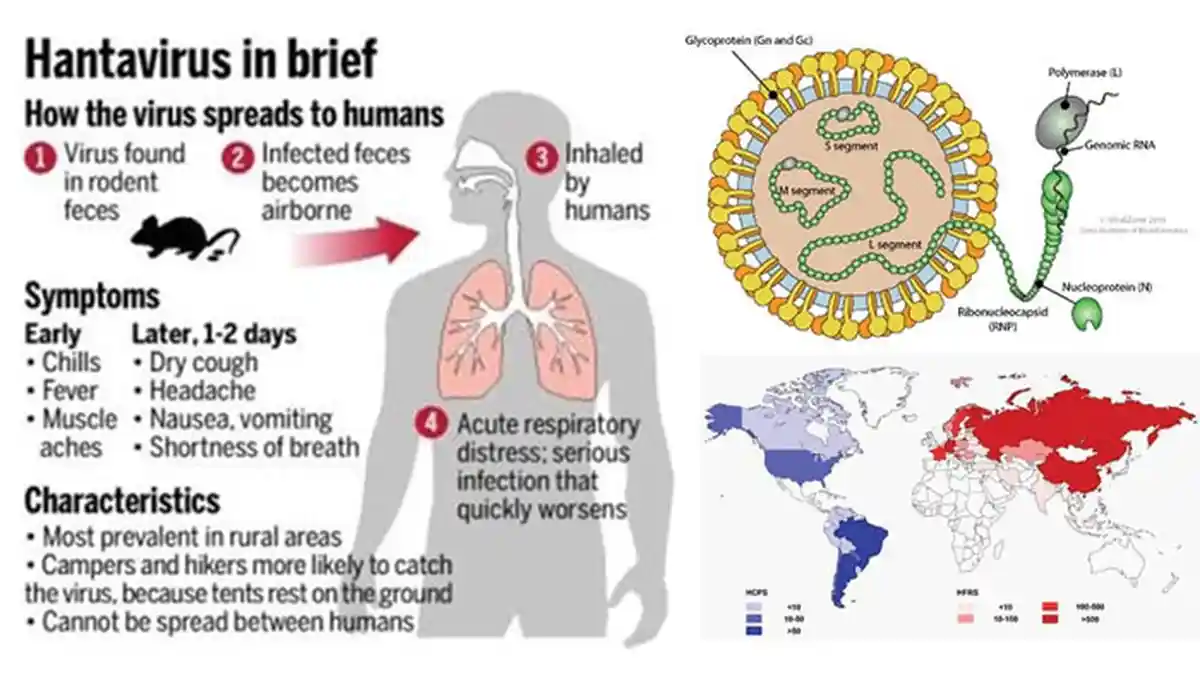 Gejala Orang Terinfeksi Hantavirus dan Ciri-cirinya, Terbagi 2 Jenis, Punya Masa Inkubasi 8 Minggu