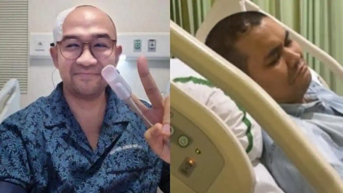 Termasuk Iwet Ramadhan hingga Indra Bekti, 5 Artis Ini Pernah Alami Pendarahan di Otak