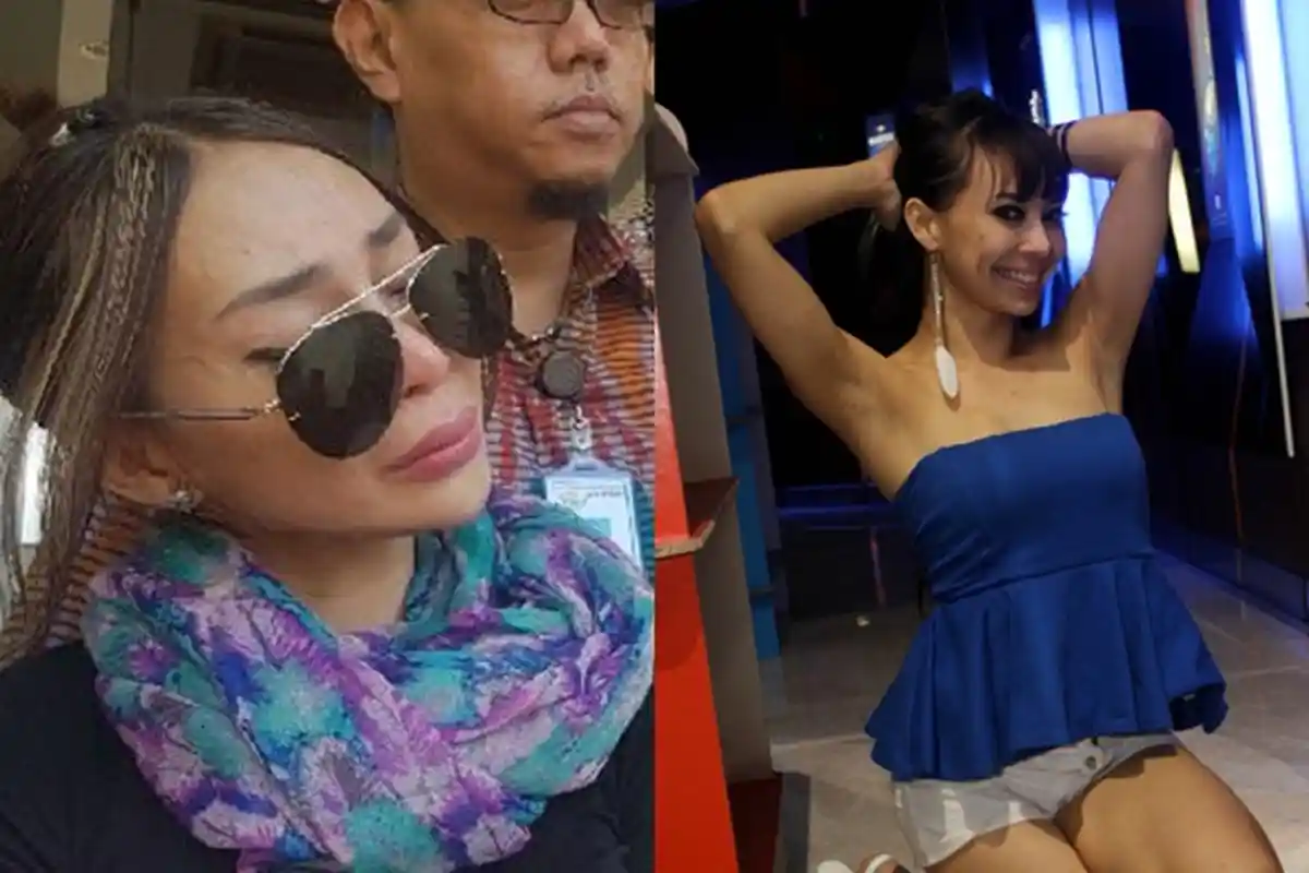 Gusti Rosaline Laporkan Mantan Sekjen Parpol, Tunjukkan Luka Dianiaya Terutama Bagian Ini