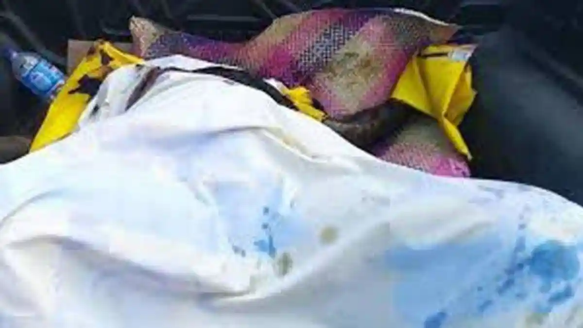 Pria Beristri Siramkan Air Keras ke Wajah Kekasihnya   