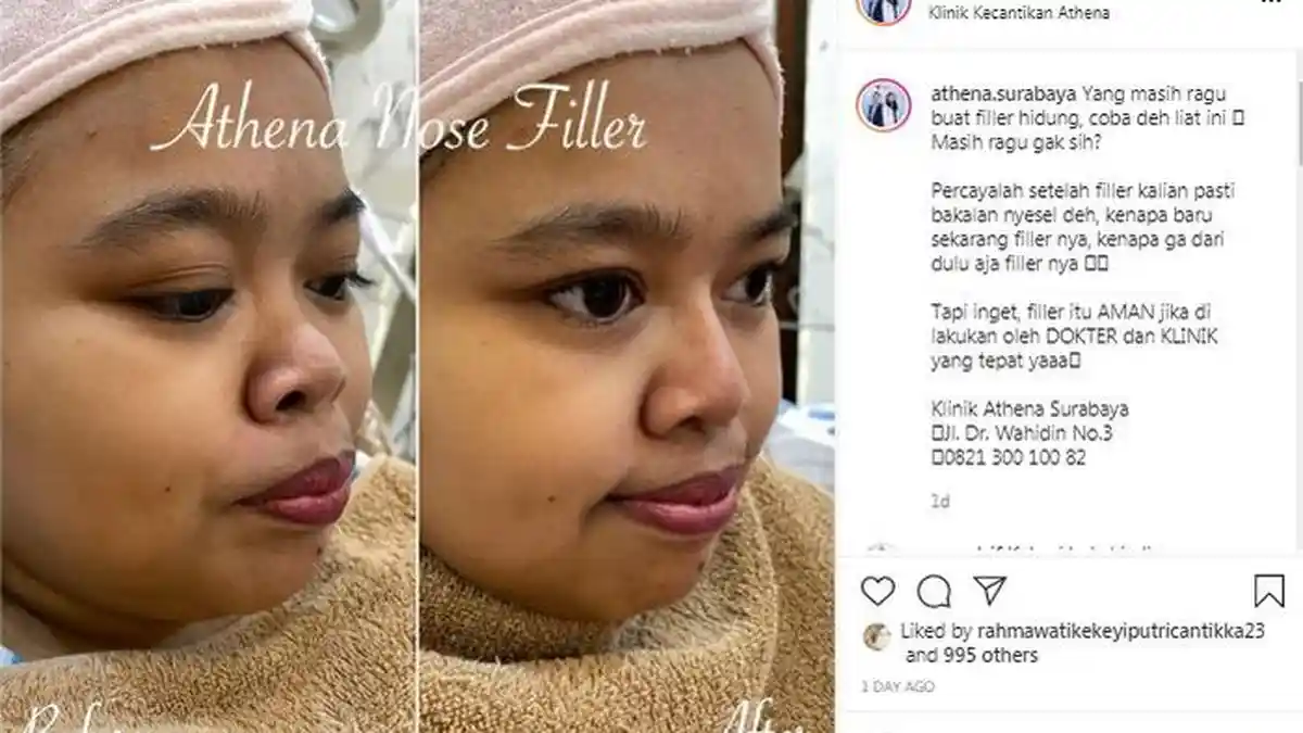 Alasan Kekeyi Permak Hidung, Bukan Tak Pede, Ada Hubungannya dengan Make Up