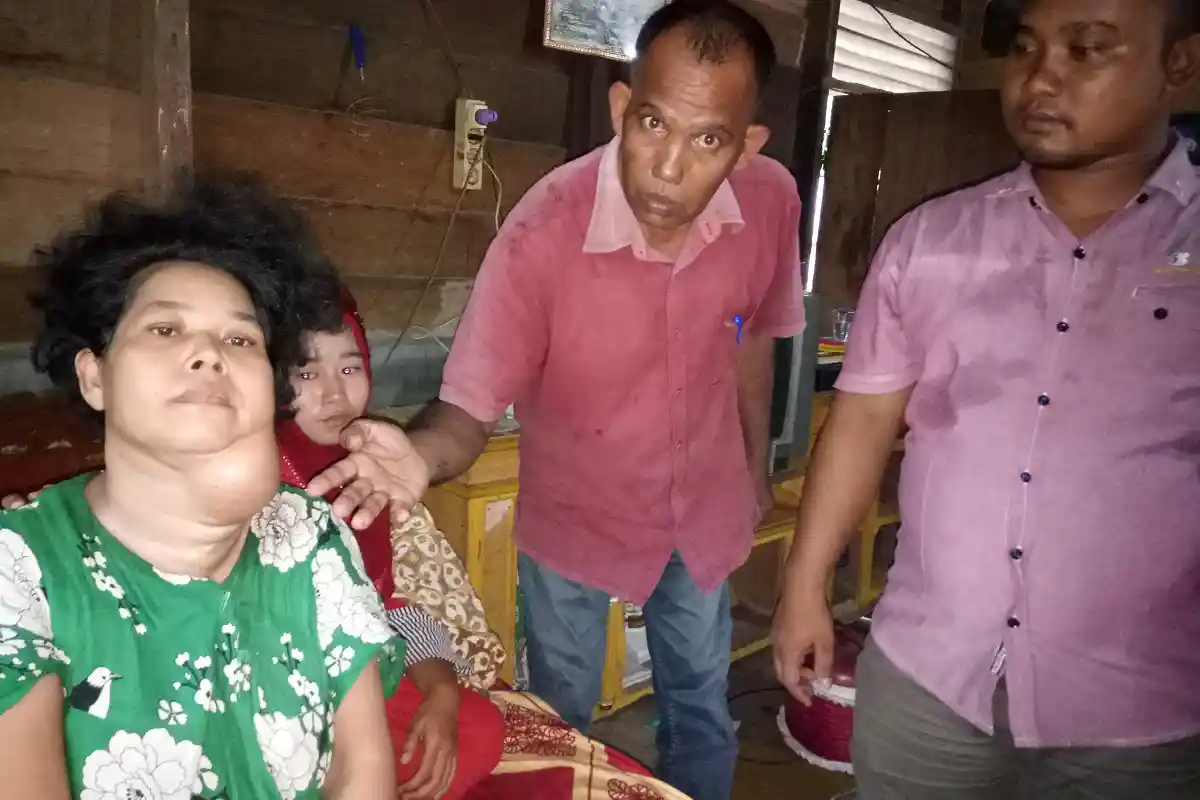 Kisah Nurmala Bermula dari Benjolan Kecil di Leher, Enam Tahun Lalu