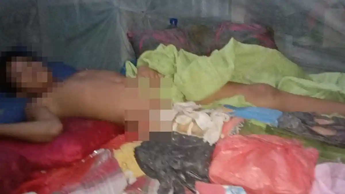 Bocah SD Dibanting Tetangganya Hingga Patah Tulang, Polisi Belum Tangkap Pelaku