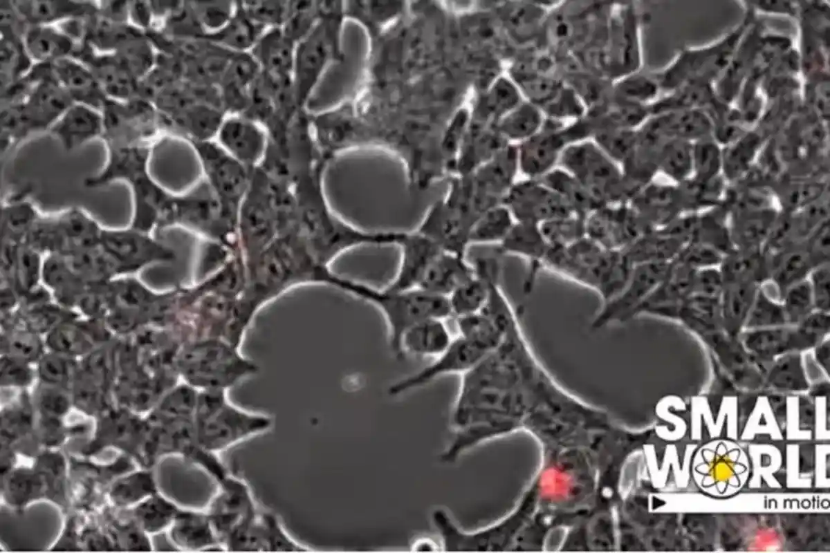 Dominan di Banyak Negara, Studi Ini Ungkap Alasan Mengapa Covid-19 Varian Delta Lebih Menular