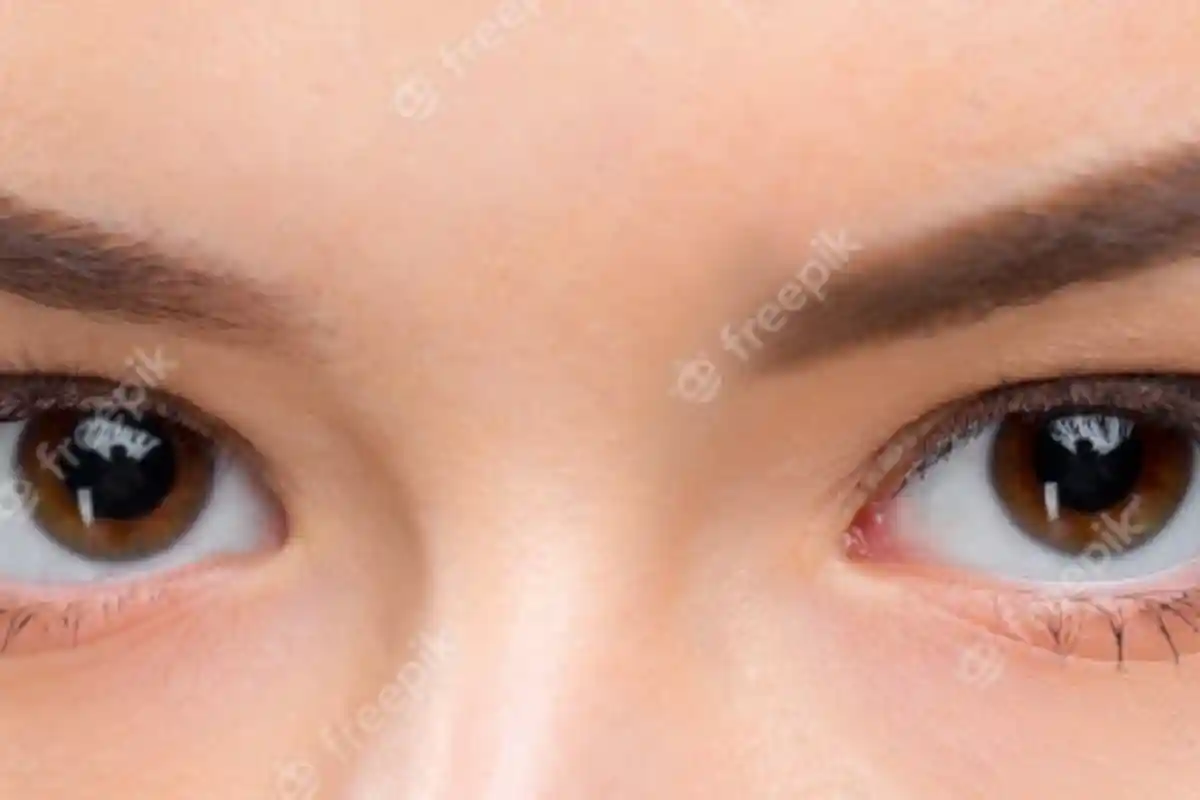 Mata Sering Kedutan? Ahli Ungkap Kaitannya dengan Kesehatan, Benarkah Sinyal Ada Bahaya dalam Tubuh?