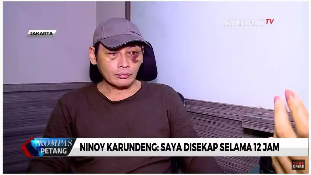 5 Fakta soal Kasus Ninoy Karundeng, Kronologi, Pemicu, Bantahan dan Keterangan Jubir PA 212