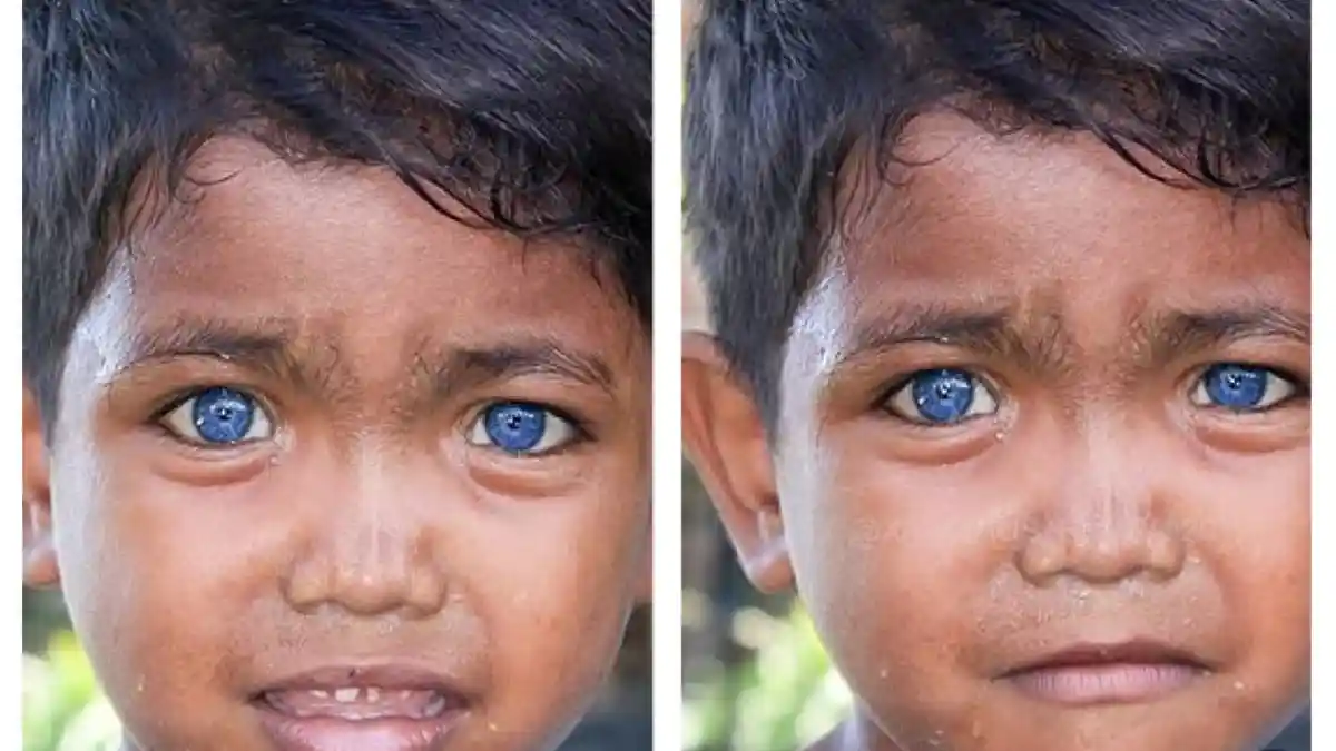 Viral di Medsos Fardan Bocah dari Buton Punya Mata Berwarna Biru