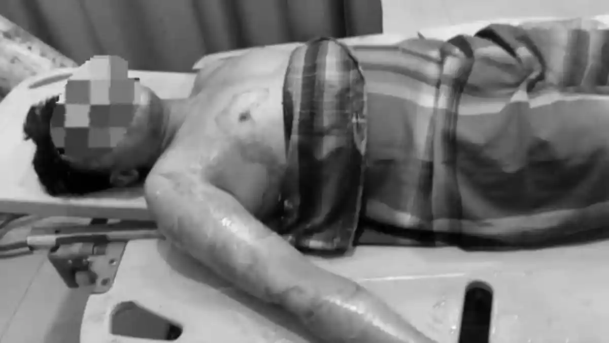 Pelaku yang Bakar Pengurus Ponpes di Langkat Sempat Merekayasa dan Memanipulasi Kejadian