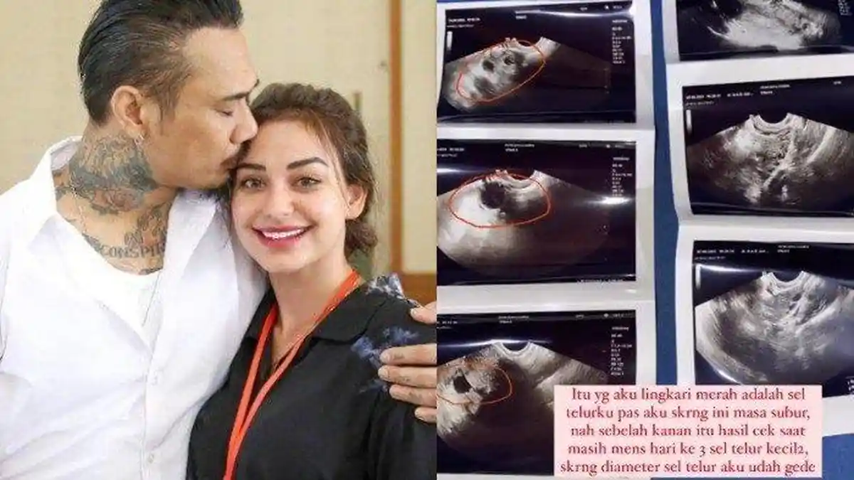 Baru Sepekan Jerinx SID Keluar Penjara, Nora Alexandra Sudah Pamer Foto Sel Telur, Hamil?