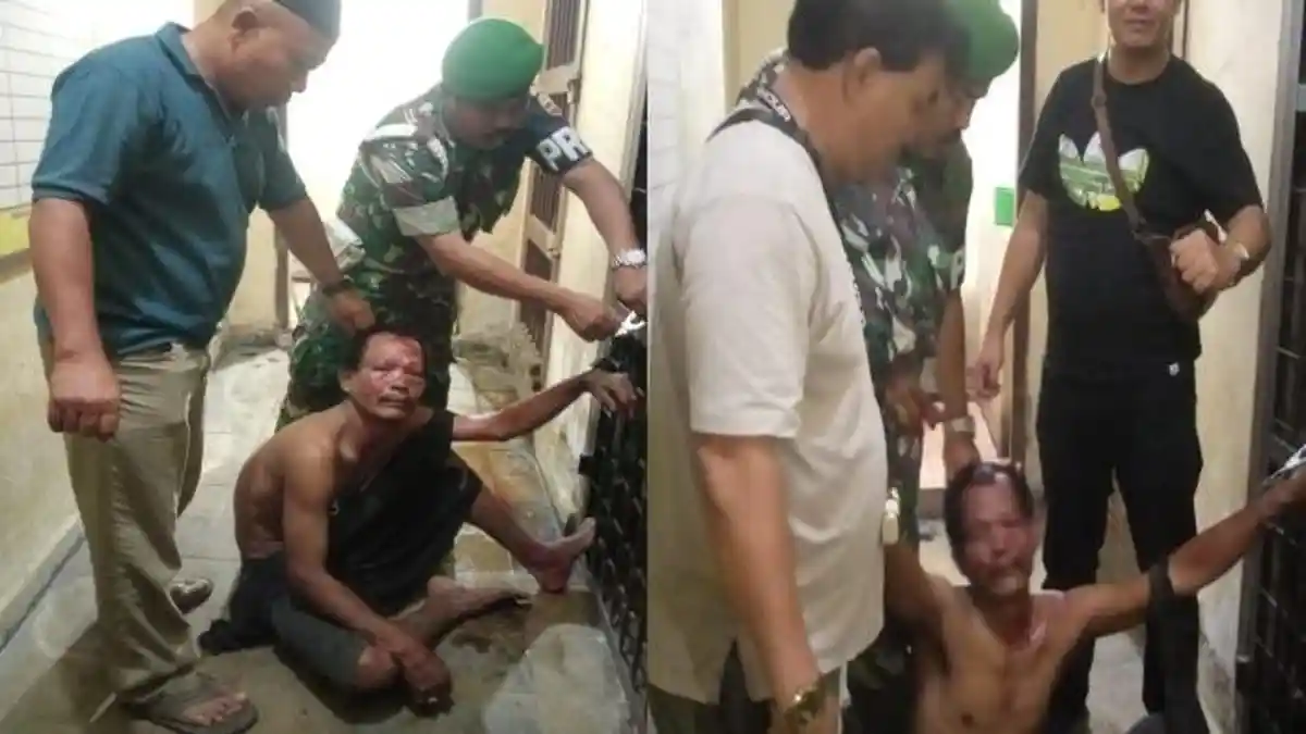 Nekat 'Cincang' Anggota Babinsa TNI AD, Pria Ini Berakhir dengan Wajah Nyaris tak Dikenali
