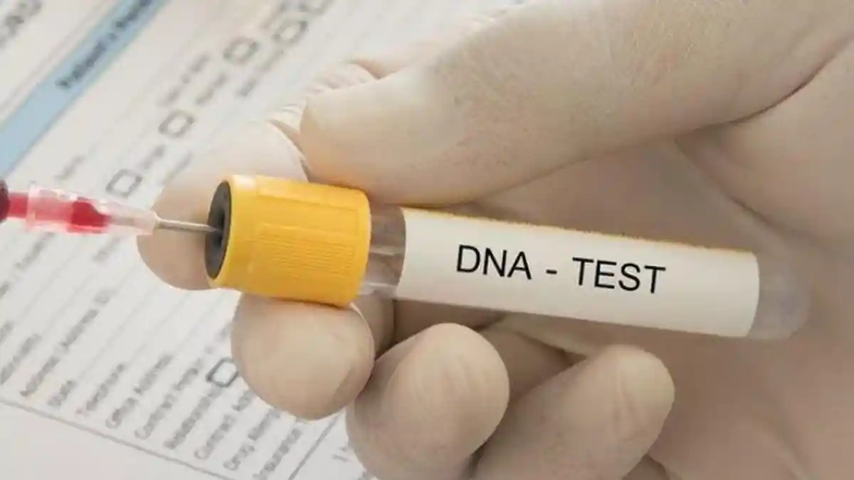 Hasil Tes DNA Berbeda, Istri Akui Tukar Sampel Rambut Suami dengan ...