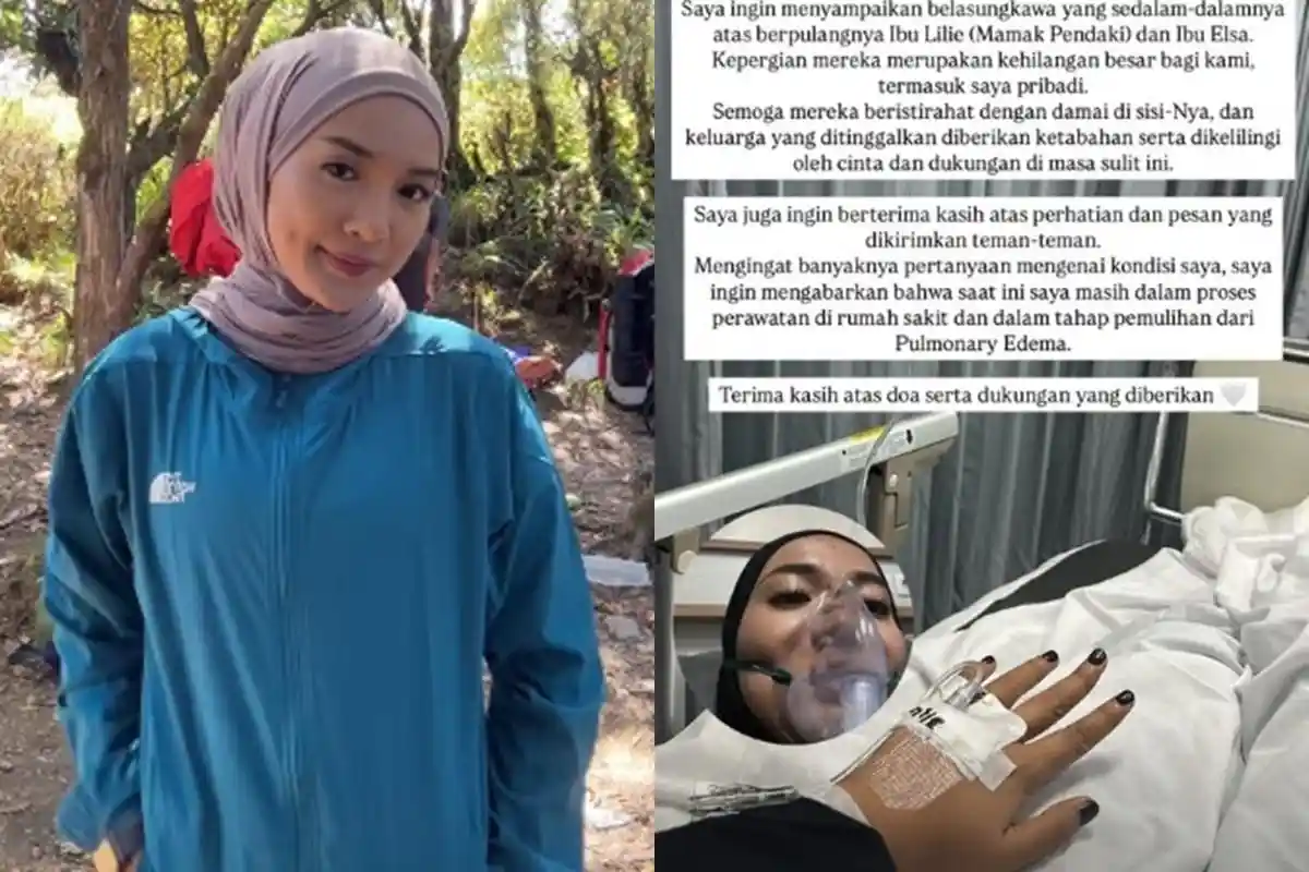 Sosok Indira Alaika Pendaki Puncak Carstensz yang Selamat, Kini Dirawat Alami Pulmonary Edema