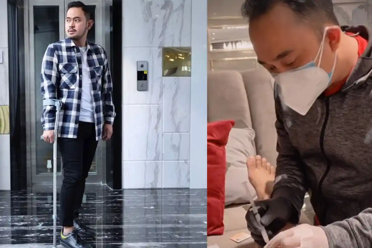 Bos Juragan 99 Cedera Lutut Karena 'Disliding Bonucci', Tim Dokter Arema FC Langsung Turun Tangan