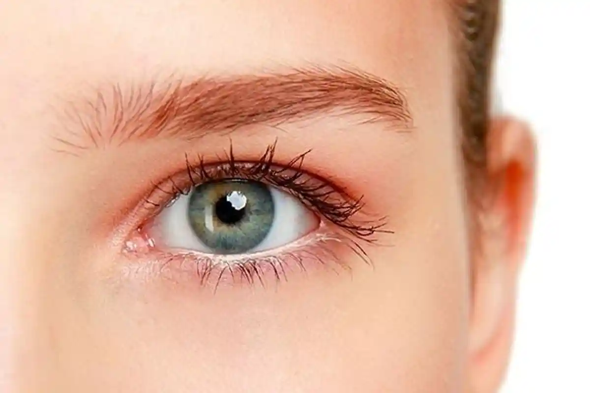 Waspadai Jika Belek Berubah Menjadi Begini