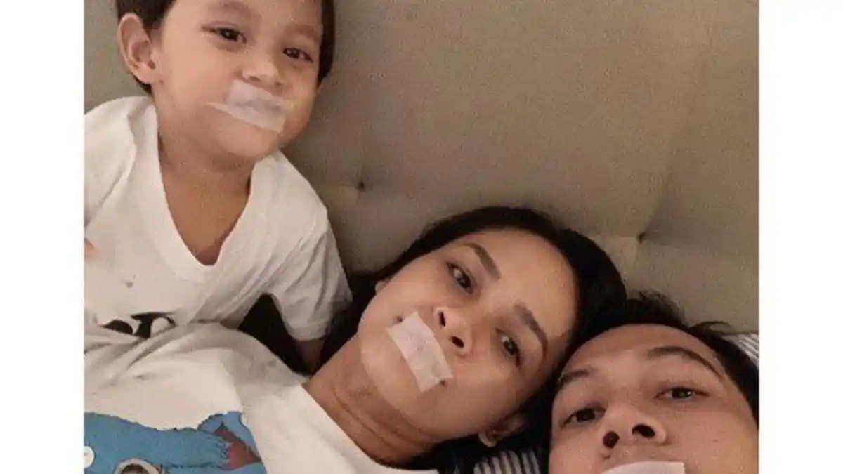 Tidur Mulut Diplester Ala Penyanyi Andien, Begini Dampak Kesehatannya Menurut Dokter