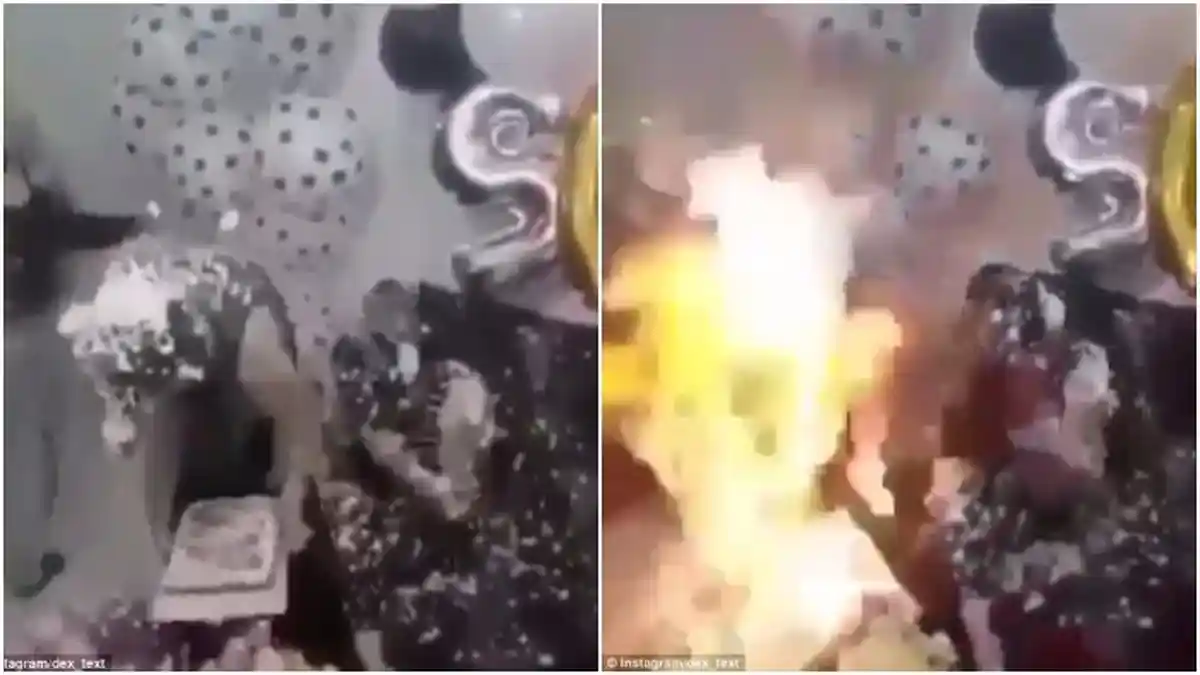 Dua Gadis Terbakar Gara-gara Hal Sepele , Pesta Ultah Mendadak Berubah Jadi Bencana