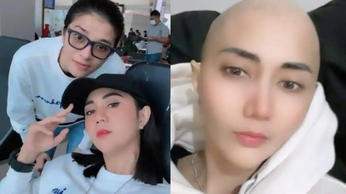 Ikhlaskan Diri Jadi Botak, Artis Cantik Ini Berjuang Lawan Kanker Ganas : Semua Upaya Aku Jalani