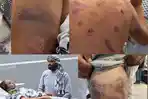 kondisi-relawan.jpg