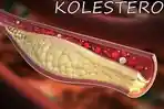 Ilustrasi-kolesterol.jpg